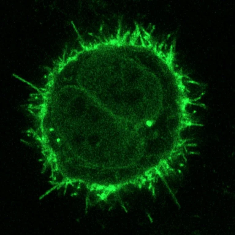 Fluorescence micrograph of a single cell with a bright green membrane and many fine protrusions