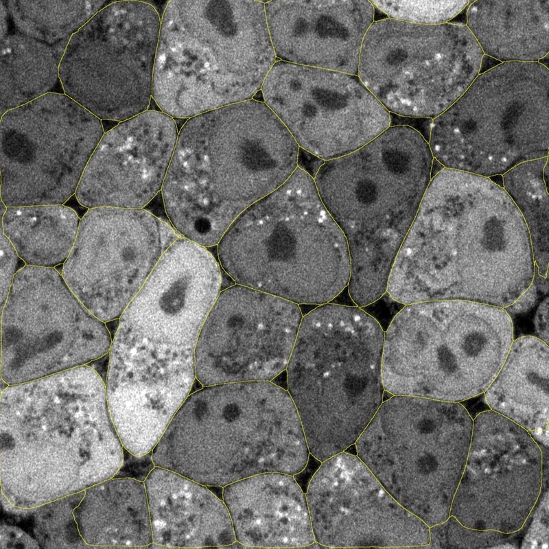 Greyscale micrograph of densely packed cells, each outlined in yellow
